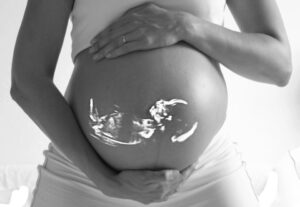 Gravid og tandbehandling: røntgen, bedøvelse og sart tandkød